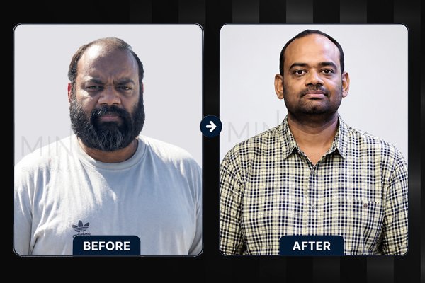 Minus Before and afterArtboard 1.jpg
