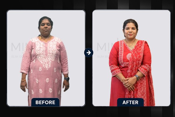 Minus Before and afterArtboard 2.jpg