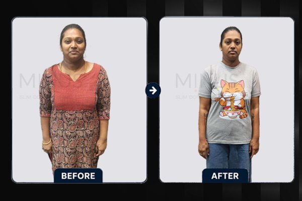 Minus Before and afterArtboard 5 copy.jpg