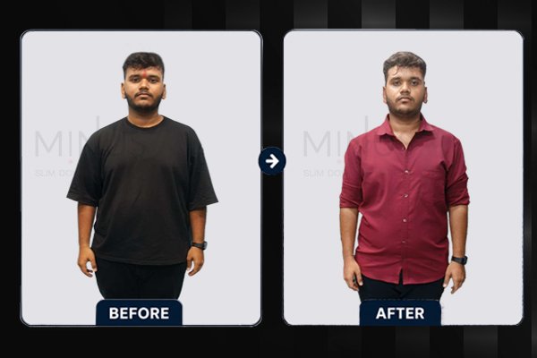 Minus Before and afterArtboard 5.jpg
